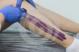 Close-up Of A Beautician Depilation With Hot Wax Woman`s Leg In Beauty Spa. Body hair removal. Hair removal process on female leg
