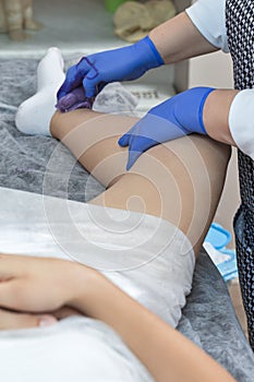 Close-up Of A Beautician Depilation With Hot Wax Woman`s Leg In Beauty Spa. Body hair removal. Hair removal process on female leg