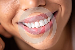 Close up of a beautiful smile with shining white teeth