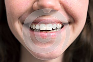 Close up of beautiful smile of young woman with white healthy teeth