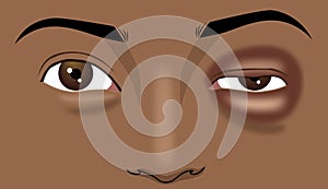 Close-up the black man\'s red eye is swollen, illustration drawing