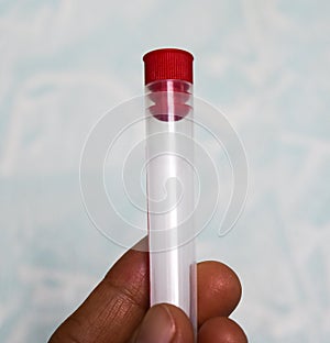 Close up blood tube for CBC example.