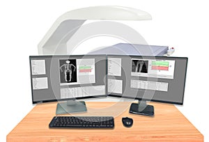 Close up Bone density whole body  and wrist ,The X-ray department of hospital used for diagnose osteoporosis symptoms.Surface