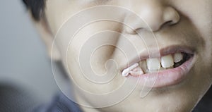 Da ragazzo bocca mordere garza bocca dopo estrazione di un dente sul clinica da indagine confine un gestione 