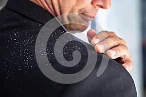 Businessman Brushing Off Fallen Dandruff On Shoulder