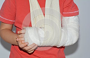A close-up of a child  a four year old boy with a broken arm in a cast for the immobilization of a broken bone