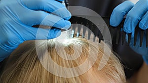 Close-up of a client's head during an examination by a trichologist.