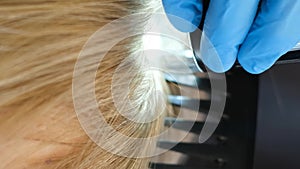 Close-up of a client's head during an examination by a trichologist. Vertical video
