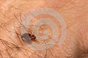 Common Bed Bug photo