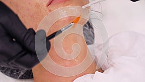 Close-up, cosmetologist, in black medical gloves, applies liquid cosmetic serum with special brush to female face