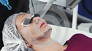Close-up cosmetologist makes carbon peeling procedure, laser flash cleans skin of patient face