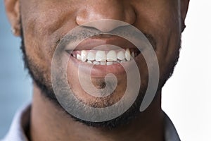 Close up crop lower face part of smiling African man
