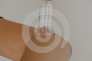 Close up on cupping bulb attached to person