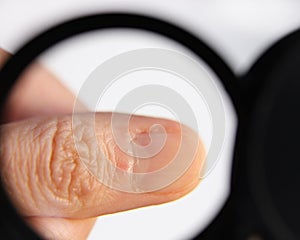 Close-up of dead thin skin at the base of the nails on the fingers. photo