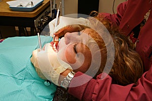 Close up of dental hygienist working on patient photo
