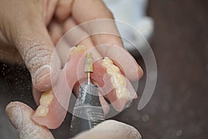 Close up Dental technician work on denture prothesis in dental l