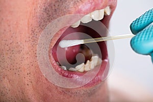 Dentist Making Saliva Test On The Mouth With Cotton Swab photo