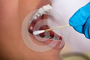 Dentist Making Saliva Test On The Mouth With Cotton Swab photo