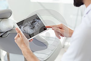 Close up of Dentist showing x-ray on tablet screen in modern dental clinic