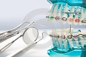 Close up dentist tools and orthodontic model.