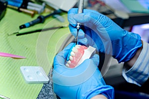 Close-up of denture manufacturing process. Tooth reconstruction