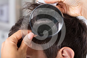 Dermatologist Checking Patient`s Hair With Magnifying Glass