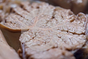 Close-up detail of the surface of the cerebellum photo