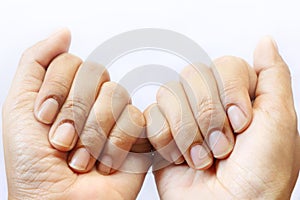 Close up dirty hand nails of Asian woman on white background have copy space for put text