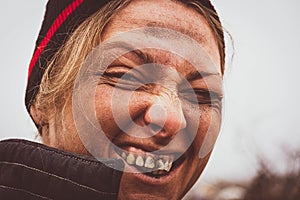 Close-up of a dirty woman`s face. A dirty bum smiles and shows black teeth on the background of a landfill