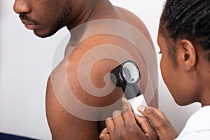 Close-up Of A Doctor Checking Pigment Skin On Man`s Back