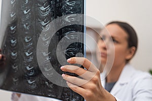 close up doctor conducts an online consultation, examining patient X-ray films and MRI scans