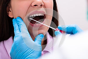 Close-up Of A Doctor Taking Saliva Sample For DNA Test