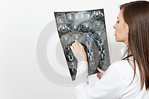 Close up doctor woman holds x-ray radiographic image ct scan mri isolated on white background. Female doctor in medical