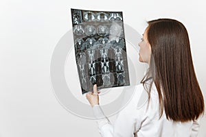 Close up doctor woman holds x-ray radiographic image ct scan mri isolated on white background. Female doctor in medical