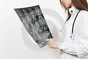 Close up doctor woman holds x-ray radiographic image ct scan mri isolated on white background. Female doctor in medical