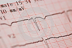 Close up of ecg graph