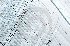 Close-up of ECG graph