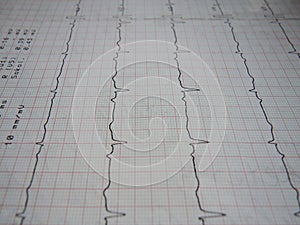 Close up of ECG graph