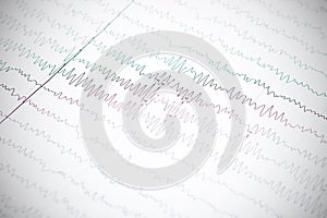 Closeup eclectroencephalogram graph on paper, epilepsy diagnosis