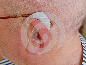 Close up of an elder`s ear with a hearing aid on, a device designed to improve hearing by making or amplifying sound audible to a