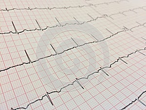 Close up of Electrocardiogram, Electrocardiography or EKG chart.