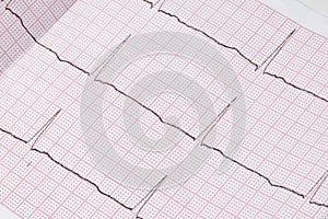 Close up of an electrocardiogram in paper form, medical healthcare.