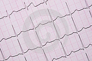 Close up of a Electrocardiograph also known as a EKG