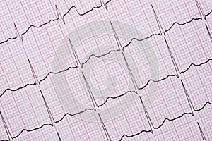 Close up of a Electrocardiograph also known as a EKG photo