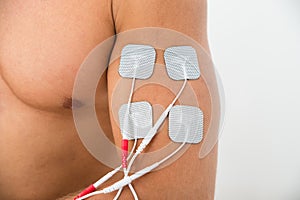Close-up of electrodes on arm