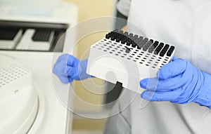 close-up of an employee of a medical bacteriological laboratory holding a container with test tubes against the