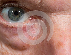 Close up of eye senior caucasian man