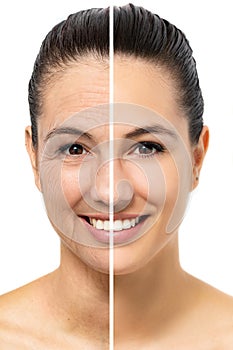 Conceptual female facial aging comparison. photo