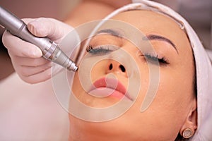 Close up of facial treatment with acupuncture pen