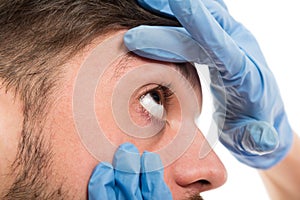 Close-up of female doctor checking male patient eye